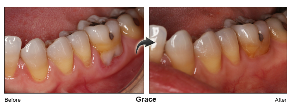 Before and Afte picture
